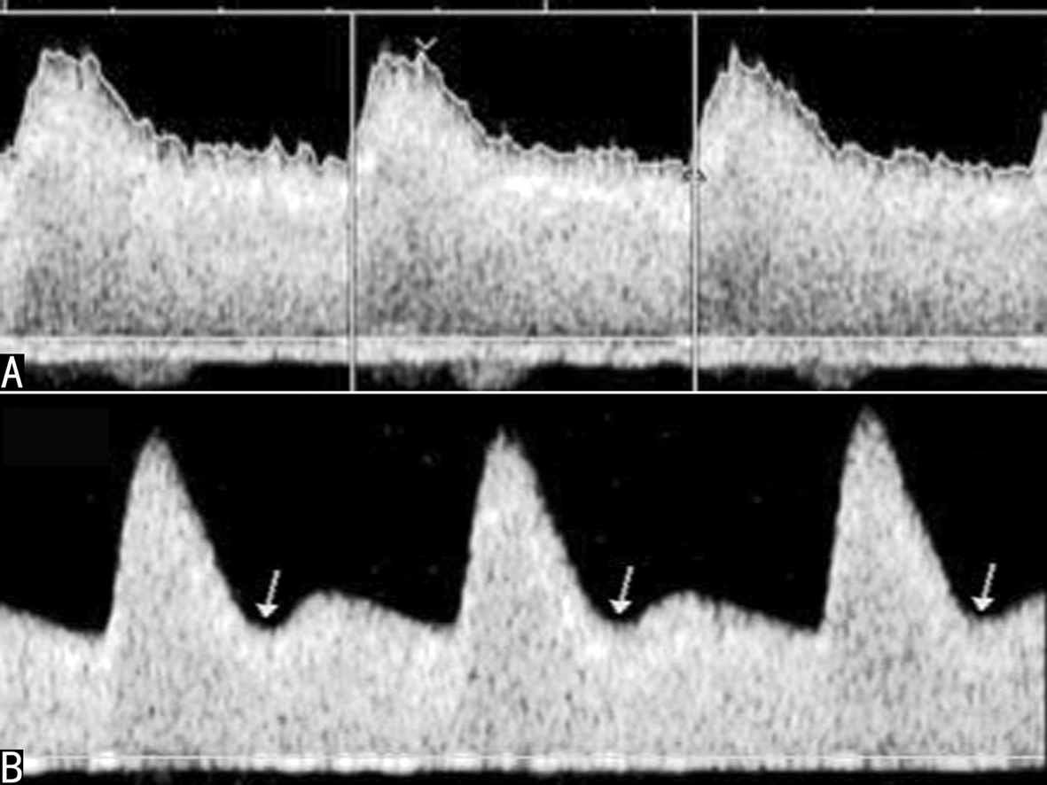 盆腔血管彩色多普勒超声孕期检查,明明白白做ct检查