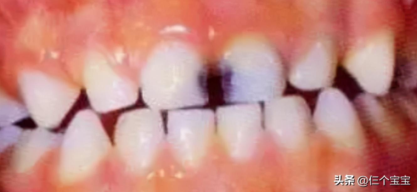 草莓籽在嘴里发了芽？刷牙少了这一步，你真的只是刷了个寂寞