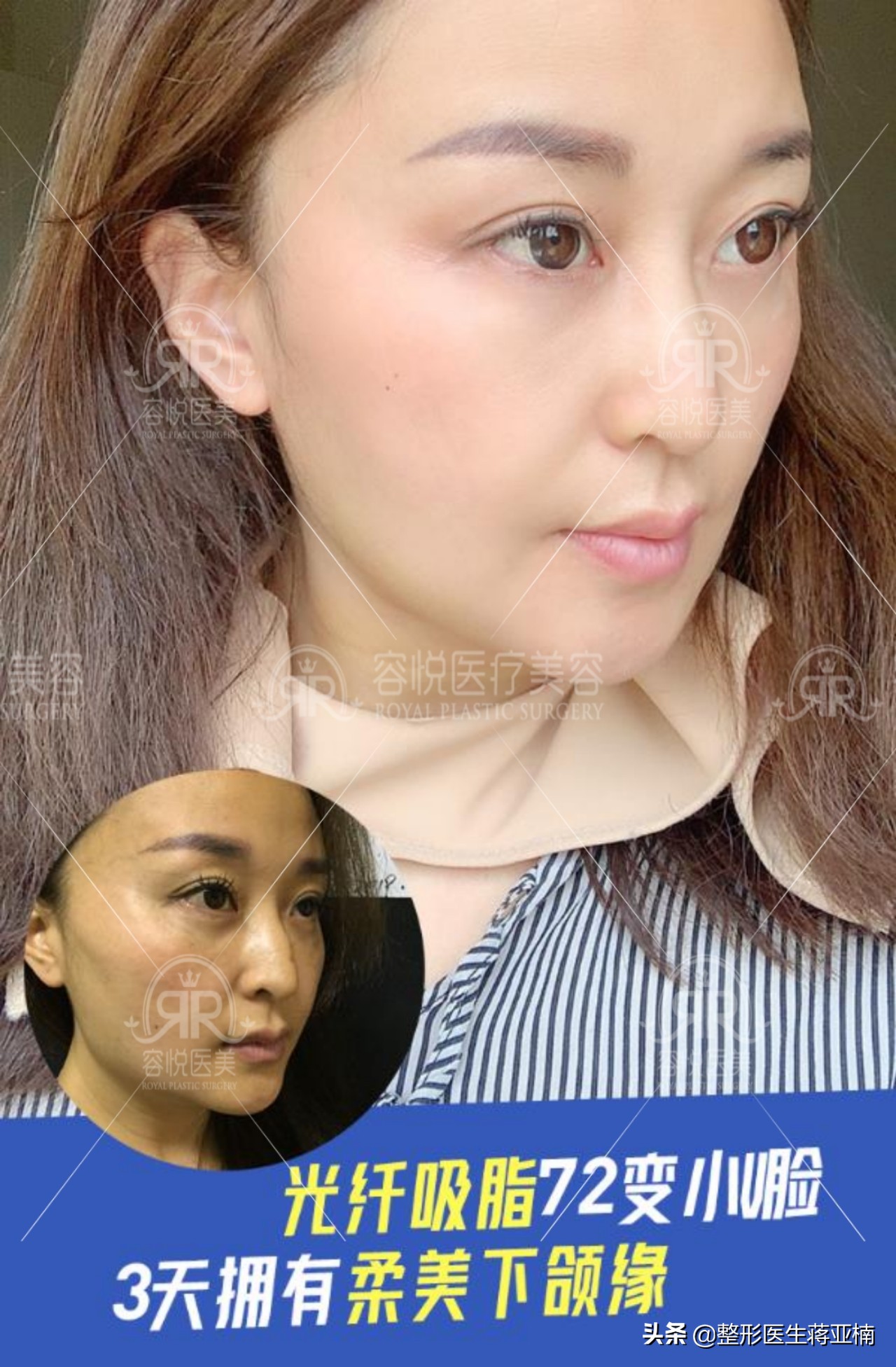 蒋亚楠整形医生照片,医疗美容医生蒋亚楠