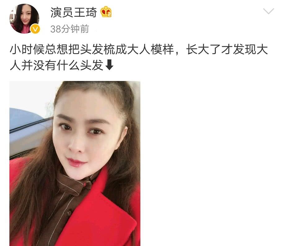 沈腾老婆现在瘦了吗,沈腾脱发严重吗