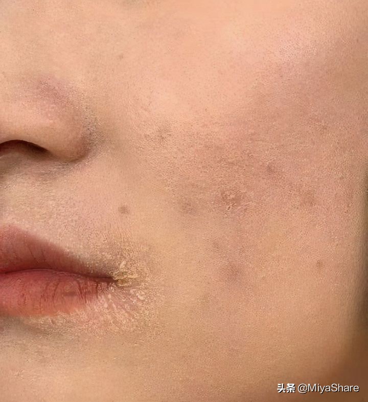 如何正确上粉底液不脱妆卡粉,涂粉底前怎么护肤不伤皮肤