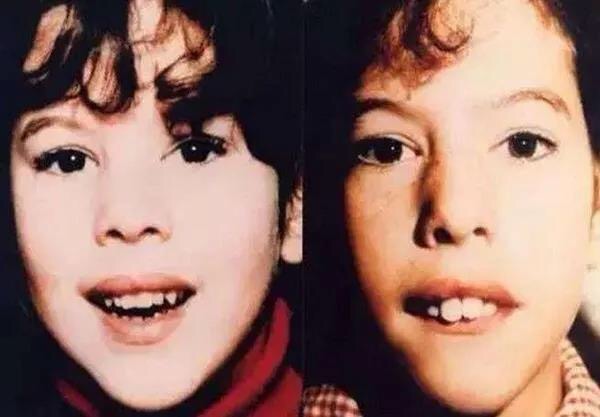 每位妈妈都可以帮助宝宝更美做的微整形，快行动起来