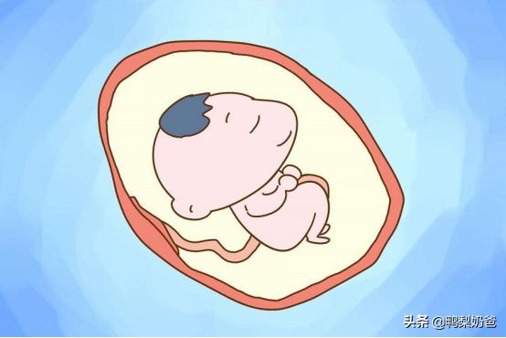 35周羊水有点浑浊怎么办,怀孕35周羊水浑浊需要住院吗