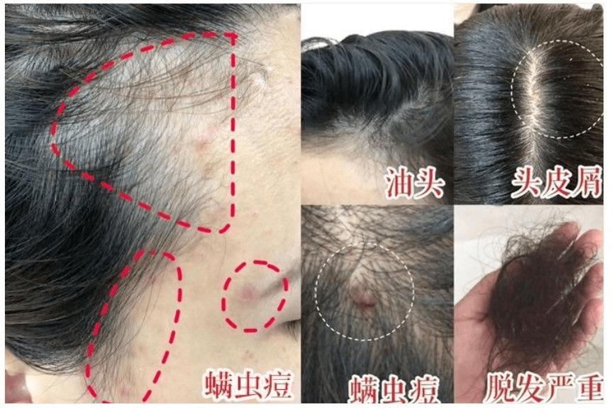 英国珀婷pertine除螨喷雾剂,瑞士珀婷pertine除螨喷雾剂