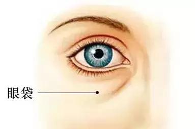 北大整形教授张宗学,全国有名的眼袋整形专家