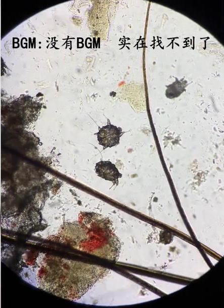 家庭除螨虫最好的神器,家里除螨虫最好的神器