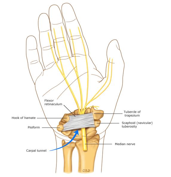 胳膊麻木是颈椎病吗,手麻不一定是颈椎病专家教你判断