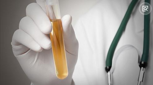 已婚女性反复尿路感染怎么办？该怎么治疗？全面解析来了