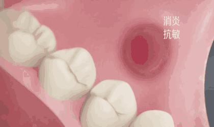 牙黄口臭怎么办用什么牙膏,黄牙口臭解决方法牙膏