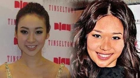 抗衰不再是简单的面部抗衰,抗衰老增加颜值