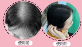 90后怎么防脱 (90后该如何防脱)