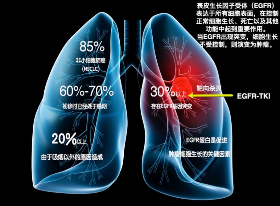 达可替尼适合哪种肺癌,肺癌靶向药可延寿几年
