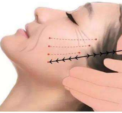 40岁去皱纹眼袋有效果吗,37岁眼袋有皱纹能去掉吗