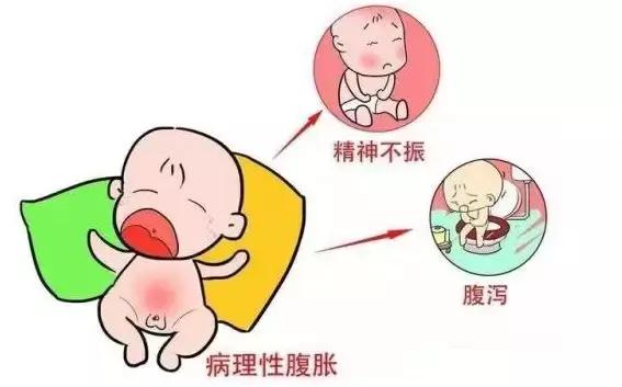 宝宝黄疸吐奶便秘,30天婴儿黄疸吐奶严重