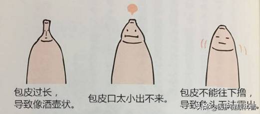 包皮到底割好还是不割,男人包皮过长是割了好还是不割好