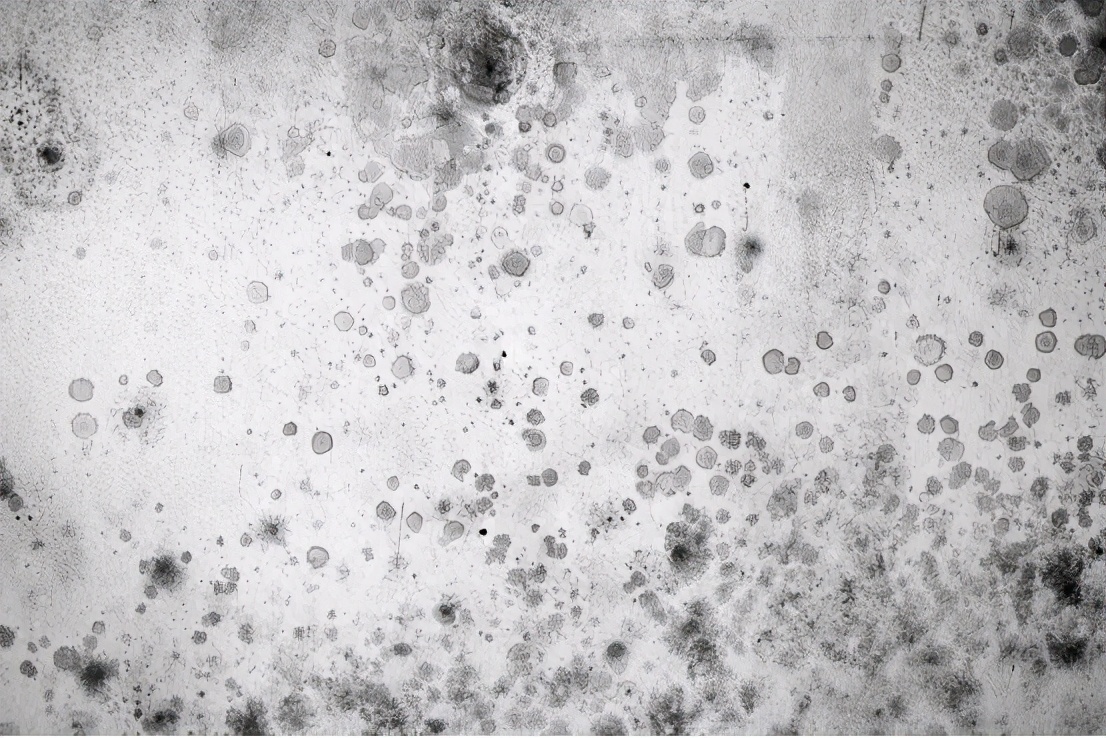 夏季皮肤过敏如何护理,换季皮肤过敏5大要点需注意