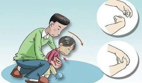 孩子吃饭异物卡喉,如果孩子出现异物卡喉怎么办