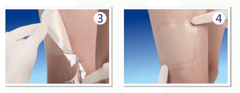 手术伤口愈合后怎么护理好得快,怎么护理伤口的视频