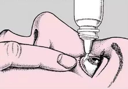 滥用眼膏剂副作用让你怀疑人生！关于红霉素眼膏，你一直不知道的