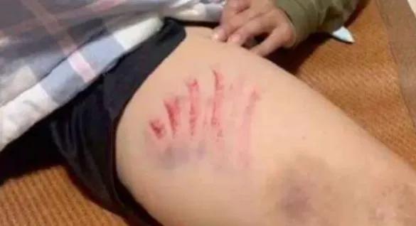 鍚嶅摠閲戜含鍏冭娈存墦,閲戜含鍏冭鐞冨憳娈存墦瑙嗛