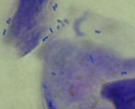 狗得了严重脓皮症怎么治,我家的狗得了皮肤病怎么处理