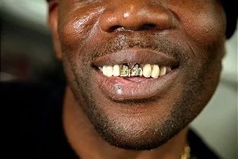 敲掉门牙,敲掉门牙小网红