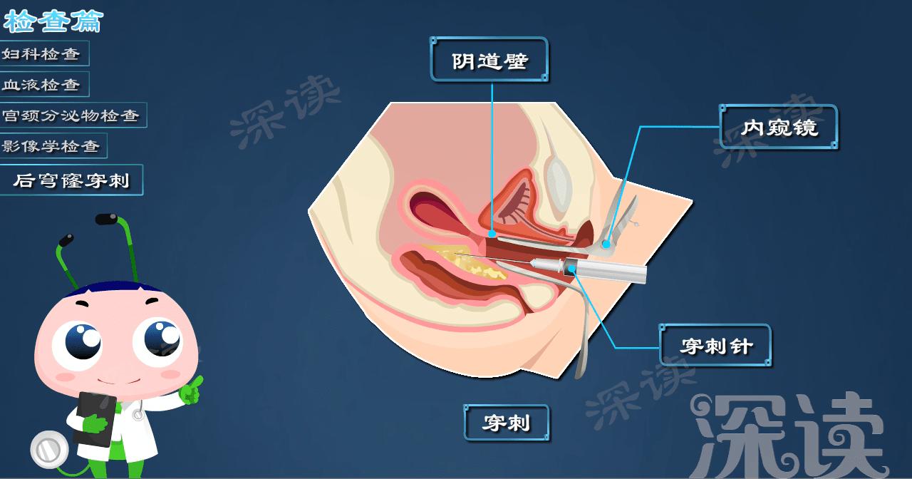腹痛白带异常,卵巢炎白带能查出吗