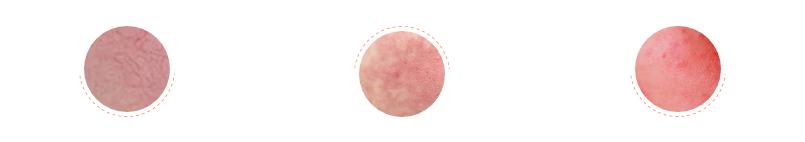 肌肤屏障受损抹什么护肤品都刺痛,皮肤屏障受损修复期间用什么保湿