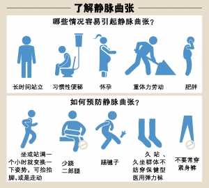 缓解静脉曲张的运动方法3种,缓解腿部静脉曲张最好的药