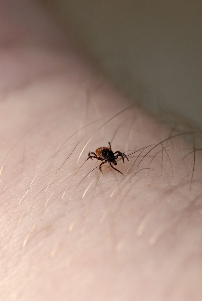 夏天到了，家里的宠物狗被蜱虫叮咬了该如何处理