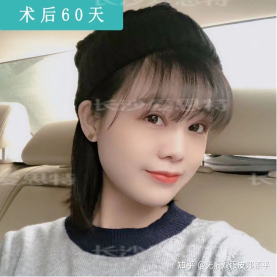 做个双眼皮就能变美,怎么贴双眼皮的时候更自然更好看