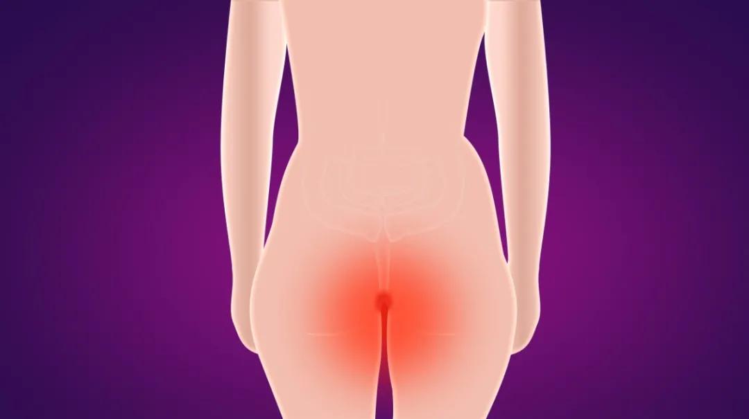 北京肛肠医院治疗肛瘘怎么样,北京东大肛肠医院肛瘘