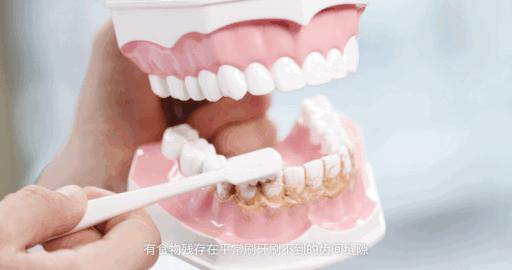 小米冲牙器伤牙,小米有品冲牙器头