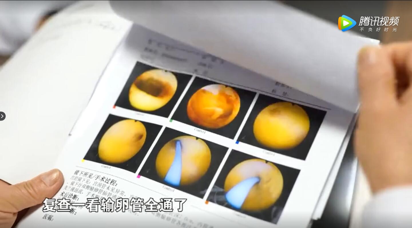 本来是易孕体质现在想怀又怀不上,为什么会有人是易孕体质