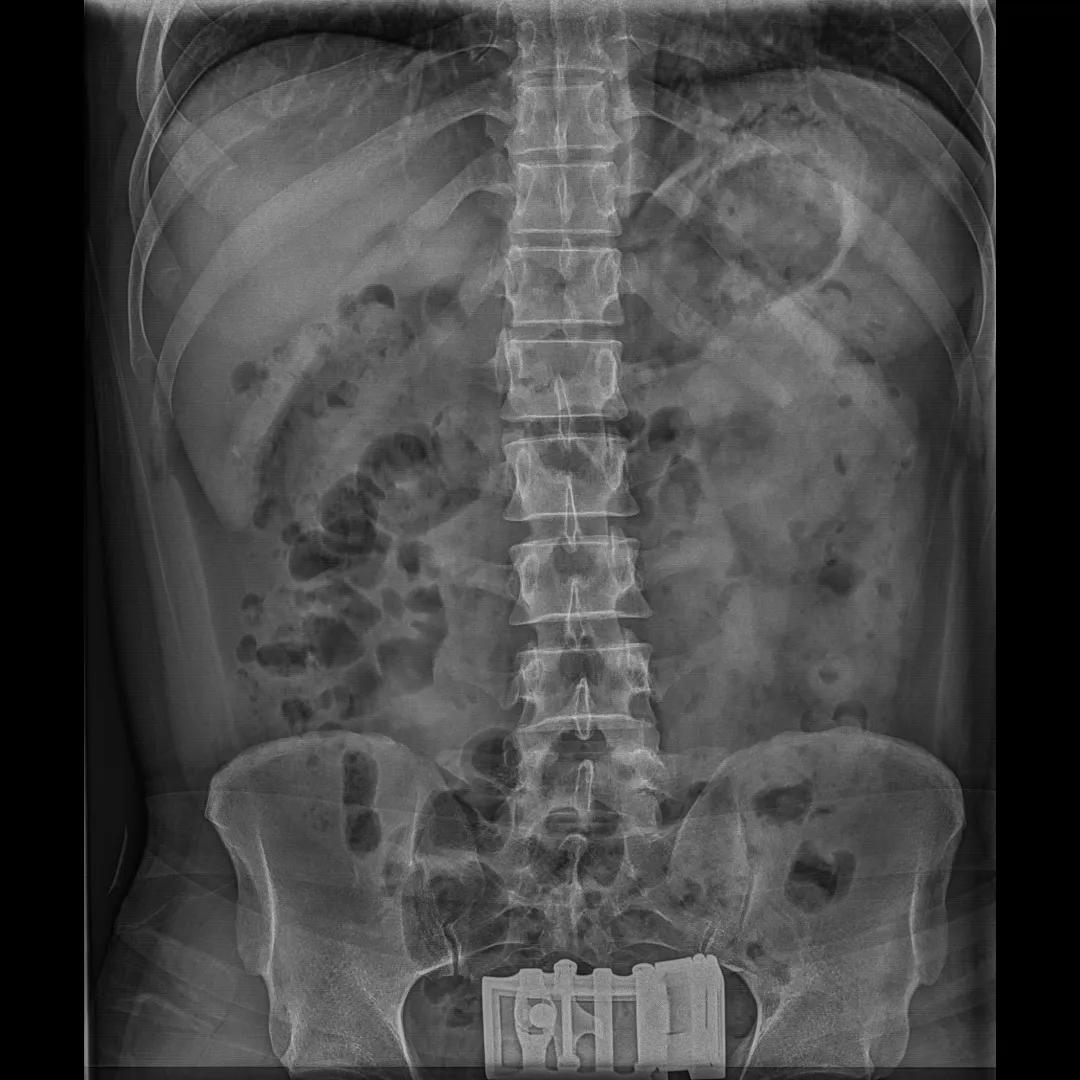 安健科技dr拍片质量怎么样,安健科技DR价格