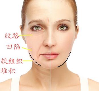 方脸怎么变成鹅蛋脸三种方法,如何判断自己是鹅蛋脸还是方脸