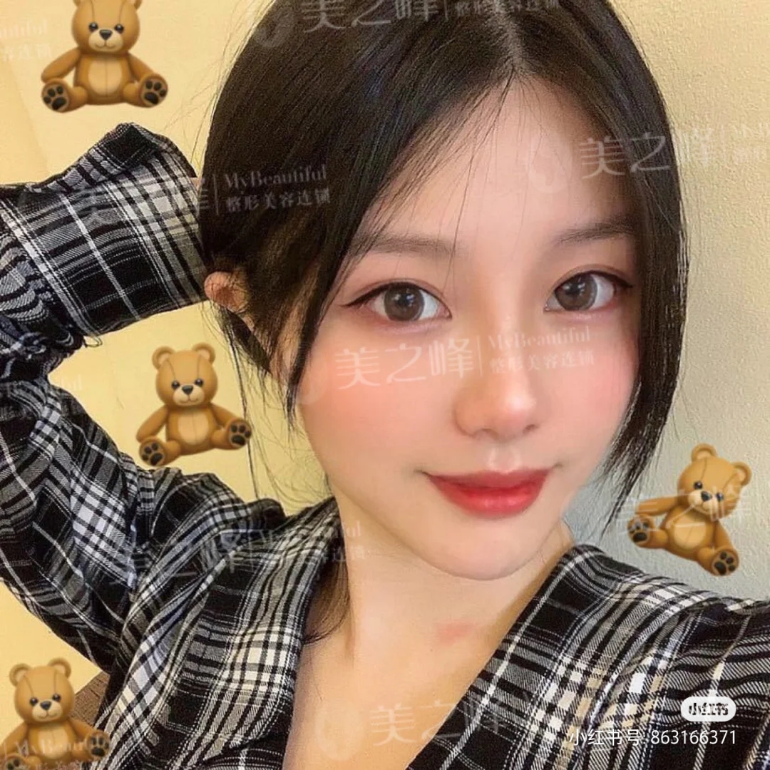 美之峰长沙,长沙美之峰最新视频