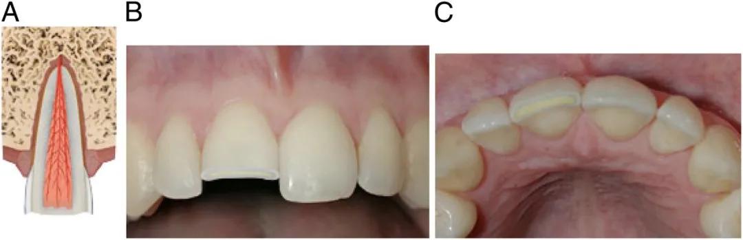 宝宝磕到牙会伤到神经吗,宝宝磕掉乳牙还能再长吗