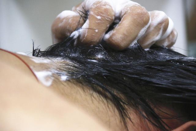 头发上有白色小颗粒怎么回事,掉的头发根部有白色颗粒怎么治