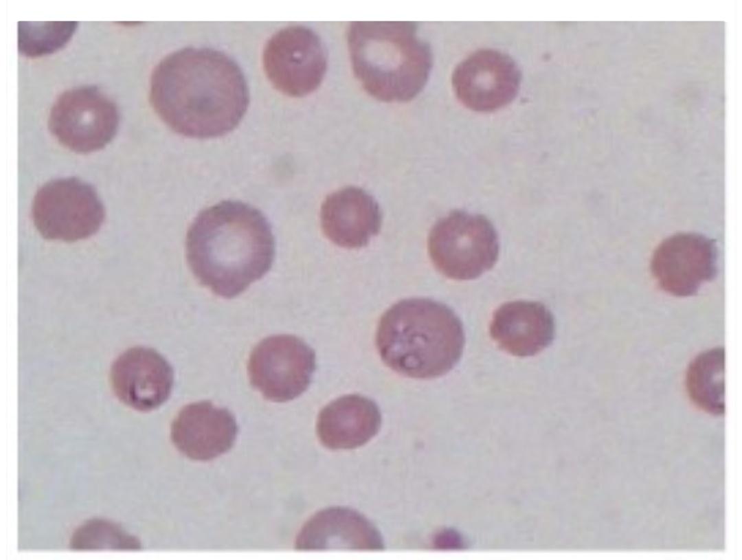 犬巴贝斯虫病会有黄疸吗,巴贝斯焦虫和蜱虫关系