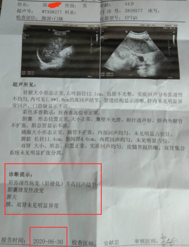 肝癌喝中药肿瘤缩小又转移了,早期肝癌喝中药肿瘤缩小了