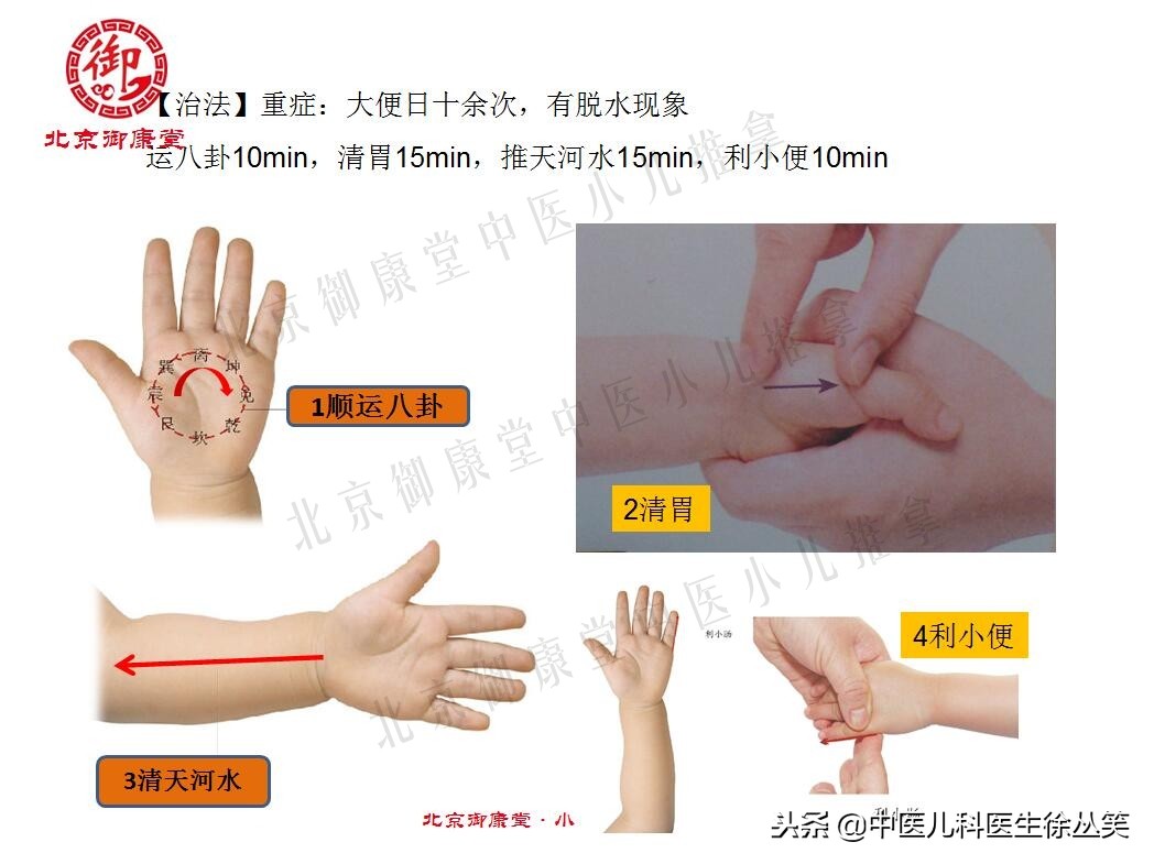 孩子拉肚子伴有发烧怎么推拿,小孩腹泻高烧是什么原因