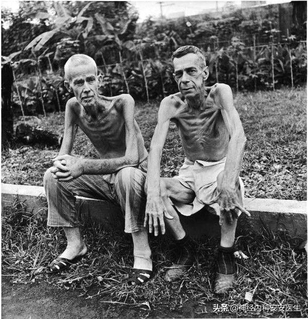 手脚浮肿发麻什么原因,手脚浮肿是什么原因吃什么中成药