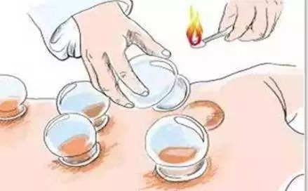 拔罐后为啥有的罐印有的深有的浅,拔罐对人是有好处还是有坏处