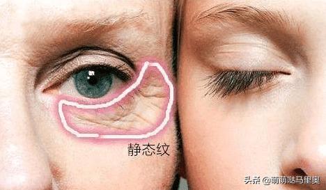 维生素e怎样用去皱纹,维生素e怎样用才达到淡斑的作用