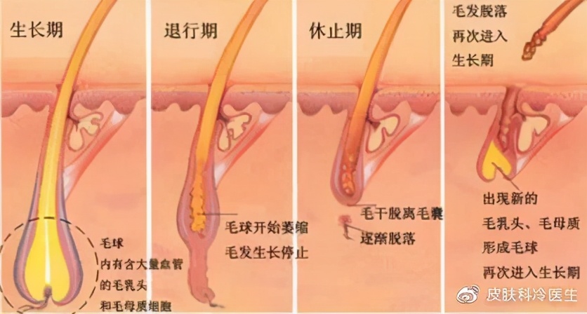 激光脱毛最全科普,激光脱毛的十大问题