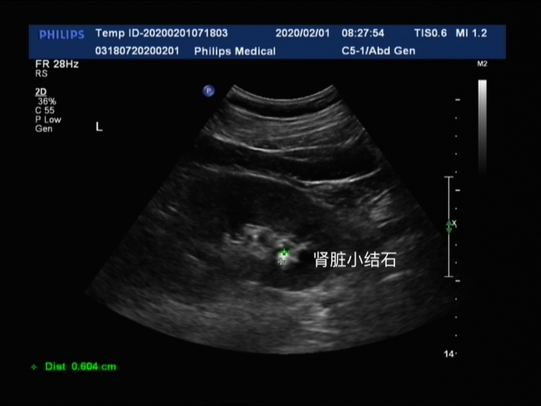 医院泌尿外科都看些什么病,哪些病需要去看泌尿外科