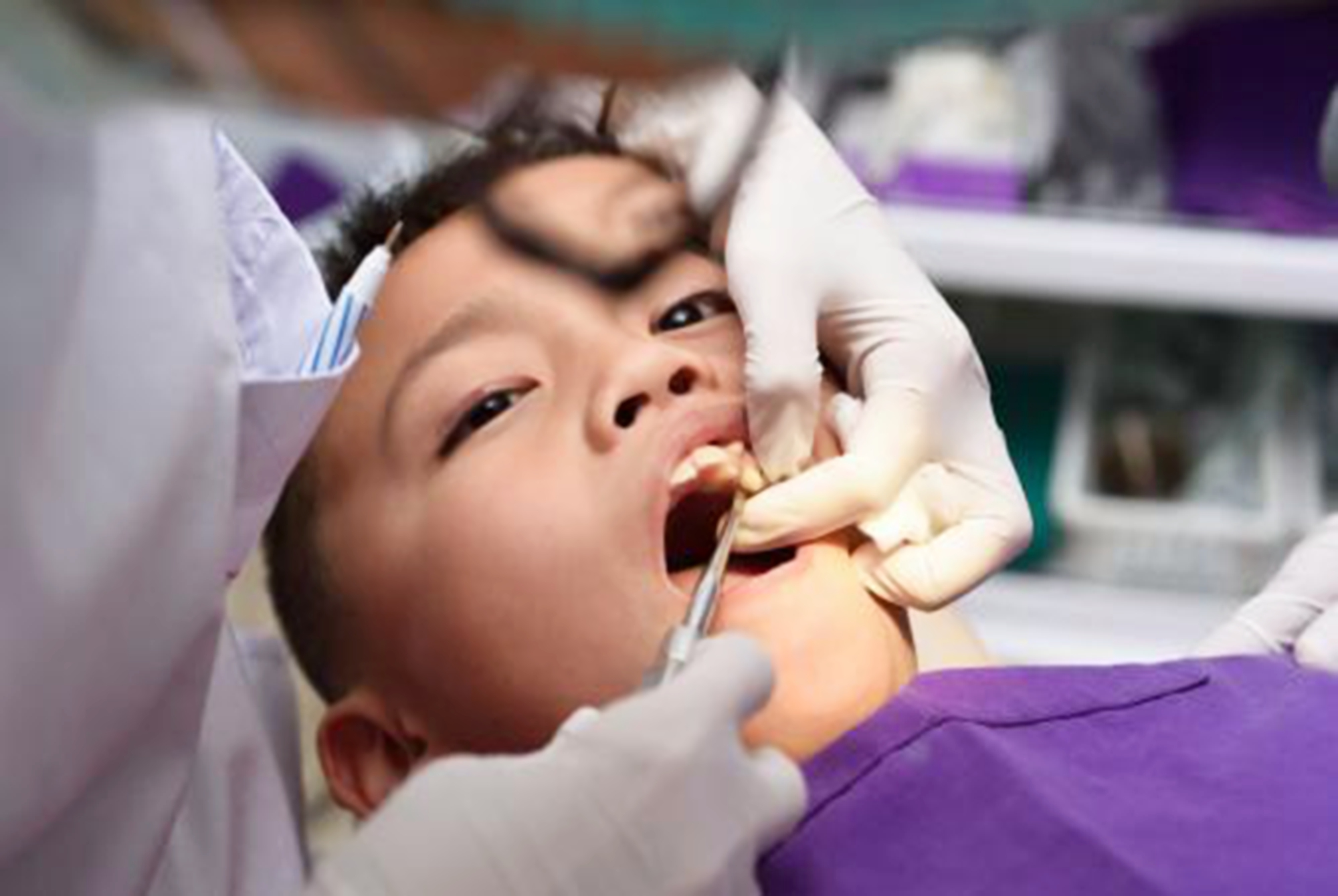 宝宝掉牙了应该怎么处理,宝宝掉牙了怎么办小视频