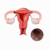 这种妇科病一半女性都有，没症状的也可能中招