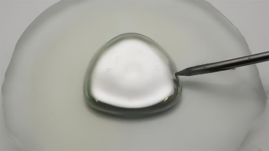 孩子误吞水银，生鸡蛋液轻松搞定，多多了解医学常识太有必要了